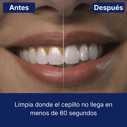 Irrigador aqua pro + boquillas gratis